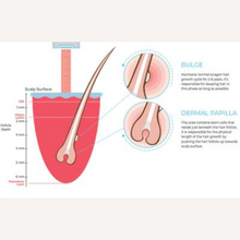 Load image into Gallery viewer, Theradome PRO LH80